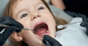pulpotomy