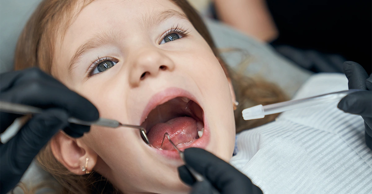 pulpotomy